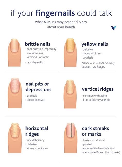 How do you prevent and treat nail ridges It&39;s not always possible to prevent nail ridges, but that doesn&39;t mean you can&39;t try Everyday . . Brown lines in nails what does it mean